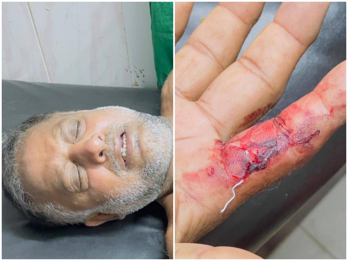 সিরাজগঞ্জের তাড়াশে অসহায় হিন্দু পরিবারের উপর রক্তাক্ত হামলা, বসতবাড়ি দখলের অভিযোগ