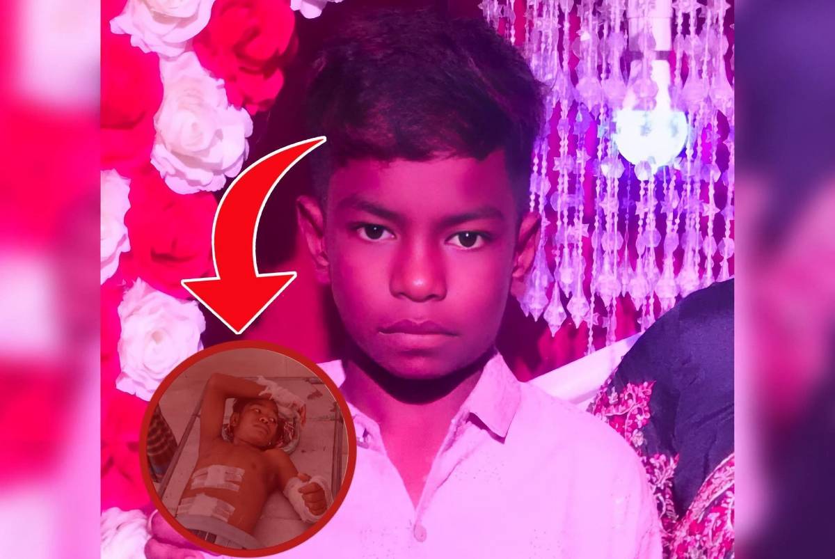 পাবনায় হরিজন সম্প্রদায়ের দুই পক্ষের সংঘর্ষে গুলিবিদ্ধ কিশোর রুদ্র হাড়ী, রাজশাহী মেডিকেলে চিকিৎসাধীন